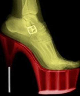 heels