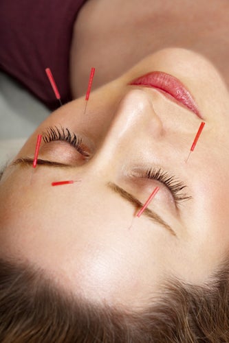 botox-skin-care-aging-acupuncture