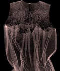 xray