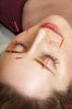 botox-skin-care-aging-acupuncture
