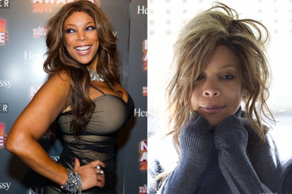 wendy-williams-plastic-surgery